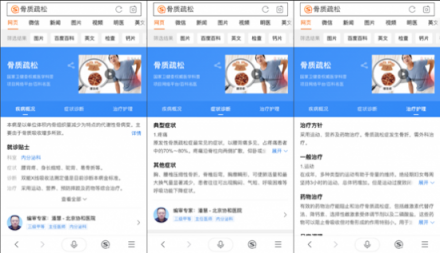 骨質(zhì)疏松你真的了解嗎？搜狗搜索教你正確守護骨骼健康