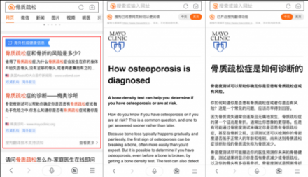 骨質(zhì)疏松你真的了解嗎？搜狗搜索教你正確守護骨骼健康