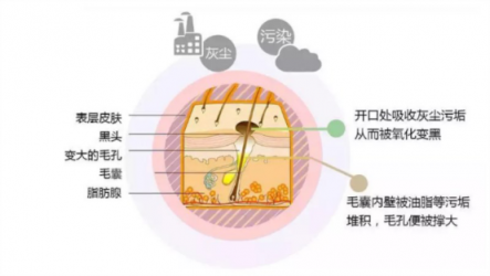 讓你的黑頭全退散！黑頭儀有用嗎？