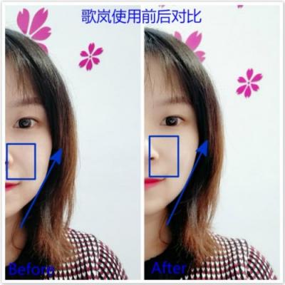 雅萌、GEVILAN歌嵐、Tripollar、NEWA美容儀到底選哪個？先評測一下再說