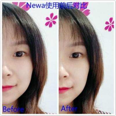 雅萌、GEVILAN歌嵐、Tripollar、NEWA美容儀到底選哪個？先評測一下再說
