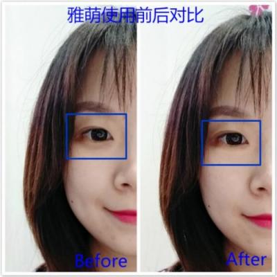 雅萌、GEVILAN歌嵐、Tripollar、NEWA美容儀到底選哪個？先評測一下再說