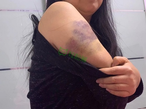 “我想有生之年看到女兒出嫁！”浙江婦女患罕見病發(fā)起輕松籌急籌19萬治療費