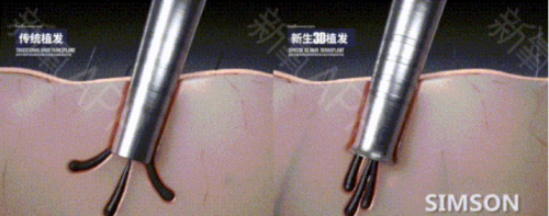 千萬主播的背后是粉絲熬夜相陪 長時(shí)間看直播會導(dǎo)致脫發(fā)？