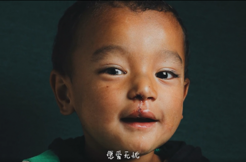 輕松集團(tuán)、輕松公益助力嫣然天使西藏行 為唇腭裂患兒再謀福利