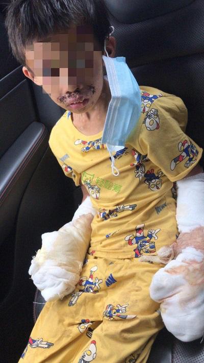 愛(ài)心大接力！輕松籌上為慘遭生父虐待男孩籌集46萬(wàn)元善款