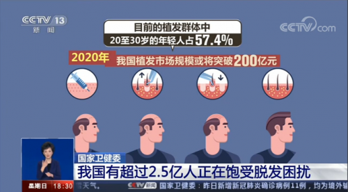 嘉興新生植發(fā)：中國(guó)脫發(fā)人群超2.5 億人 3D植發(fā)效果受認(rèn)可