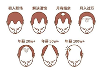 2.5億人被脫發(fā)困擾？Rogaine培健實力生發(fā)