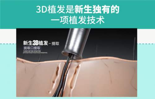選對植發(fā)機(jī)構(gòu)多重要？杭州新生3D植發(fā)二次修復(fù)助力發(fā)友煥新顏