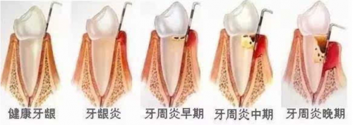 小米有品眾籌超10000000！素諾智能可視潔牙儀T11Pro為何一炮而紅？