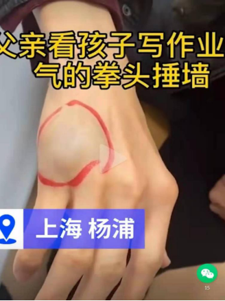虎爸輔導孩子作業(yè)致使自己受傷，不妨試試訊飛智能學習機