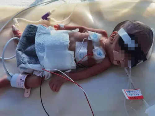 孩子剛出生就住進(jìn)ICU，水滴籌筑起生命長城