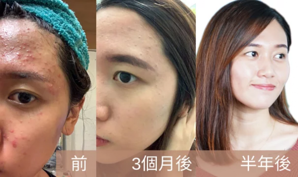 Myeong香港宮廷薈，帶你解鎖宮廷中藥新護膚方式！