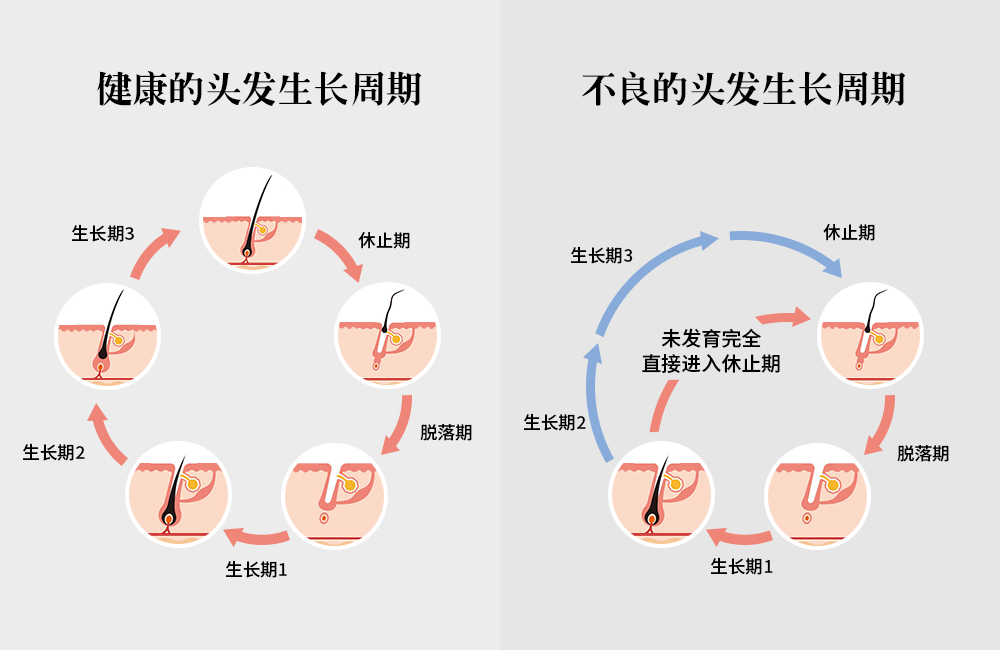 拯救頭頂大事，采用創(chuàng)新配方REDENICAL的DR ZERO來到中國