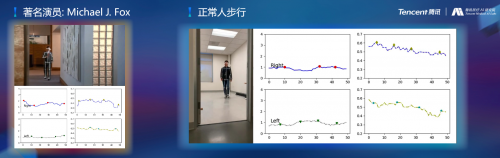 騰訊醫(yī)療人工智能研究院院長范偉：超越認(rèn)知，AI重塑運動評估