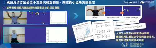騰訊醫(yī)療人工智能研究院院長范偉：超越認(rèn)知，AI重塑運動評估