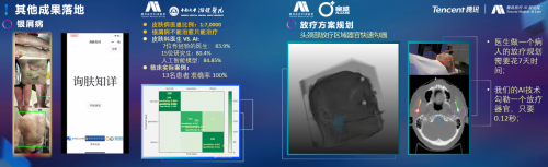 騰訊醫(yī)療人工智能研究院院長范偉：超越認(rèn)知，AI重塑運動評估