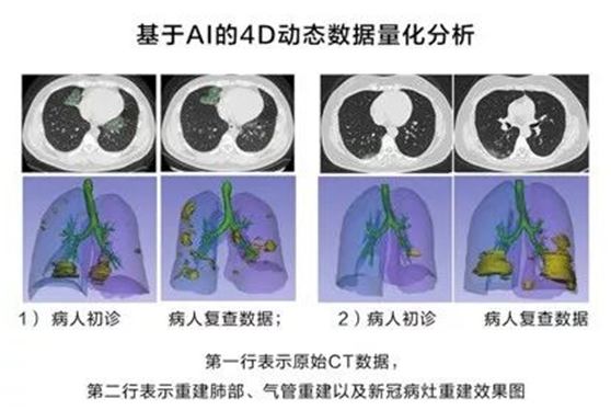 非常時(shí)期下的城市防控、生產(chǎn)與治理，華為云用AI“全鏈條“戰(zhàn)疫
