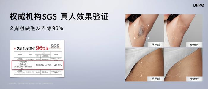 全球銷(xiāo)量第一的脫毛儀品牌Ulike發(fā)布超級(jí)脫毛技術(shù) 或?qū)?shí)現(xiàn)永久脫毛